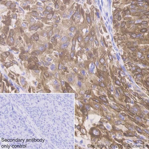 Immunohistochemistry (Formalin/PFA-fixed paraffin-embedded sections) - Anti-Cytokeratin 5 antibody [EP1601Y] - BSA and Azide free (ab214586), expandable thumbnail