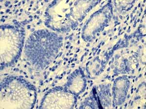Immunohistochemistry (Formalin/PFA-fixed paraffin-embedded sections) - Anti-Cytokeratin 5 antibody [EP1601Y] - BSA and Azide free (ab214586), expandable thumbnail