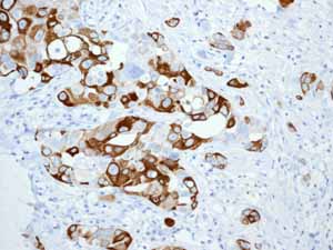 Immunohistochemistry (Formalin/PFA-fixed paraffin-embedded sections) - Anti-Cytokeratin 5 antibody [EP1601Y] - BSA and Azide free (ab214586), expandable thumbnail