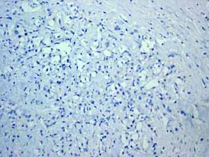 Immunohistochemistry (Formalin/PFA-fixed paraffin-embedded sections) - Anti-Cytokeratin 5 antibody [EP1601Y] - BSA and Azide free (ab214586), expandable thumbnail