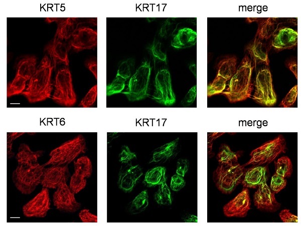 Immunocytochemistry/ Immunofluorescence - Anti-Cytokeratin 5 antibody [EP1601Y] - Cytoskeleton Marker (AB52635), expandable thumbnail
