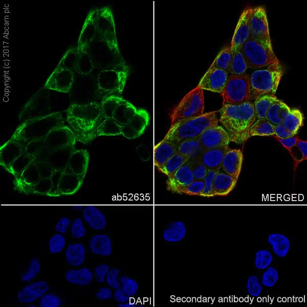 Immunocytochemistry/ Immunofluorescence - Anti-Cytokeratin 5 antibody [EP1601Y] - Cytoskeleton Marker (AB52635)