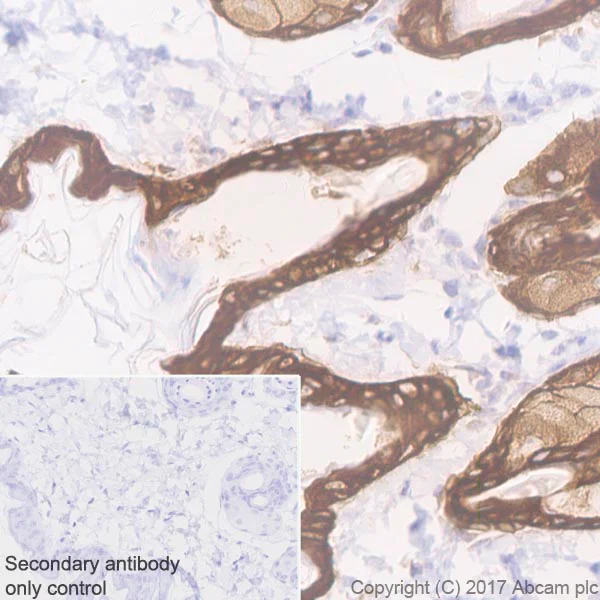 Immunohistochemistry (Formalin/PFA-fixed paraffin-embedded sections) - Anti-Cytokeratin 5 antibody [EP1601Y] - Cytoskeleton Marker (AB52635)