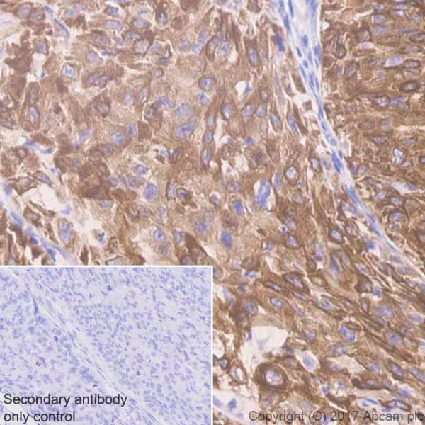 Immunohistochemistry (Formalin/PFA-fixed paraffin-embedded sections) - Anti-Cytokeratin 5 antibody [EP1601Y] - Cytoskeleton Marker (AB52635)