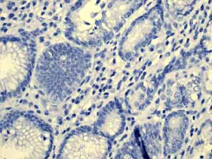 Immunohistochemistry (Formalin/PFA-fixed paraffin-embedded sections) - Anti-Cytokeratin 5 antibody [EP1601Y] - Cytoskeleton Marker (AB52635)