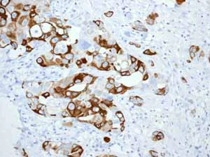 Immunohistochemistry (Formalin/PFA-fixed paraffin-embedded sections) - Anti-Cytokeratin 5 antibody [EP1601Y] - Cytoskeleton Marker (AB52635)