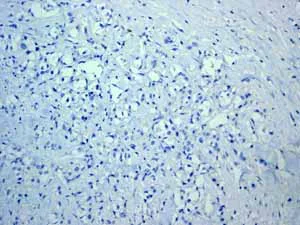 Immunohistochemistry (Formalin/PFA-fixed paraffin-embedded sections) - Anti-Cytokeratin 5 antibody [EP1601Y] - Cytoskeleton Marker (AB52635)