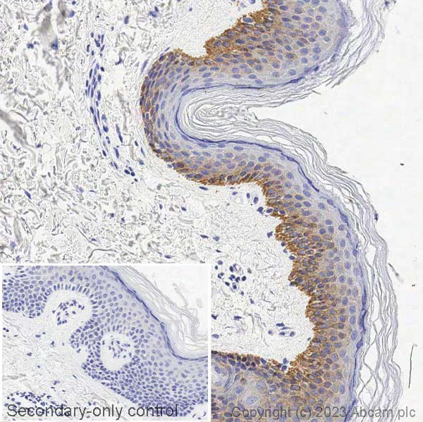 Immunohistochemistry (Formalin/PFA-fixed paraffin-embedded sections) - Anti-Cytokeratin 5 antibody [EP1601Y] - Cytoskeleton Marker (AB52635)