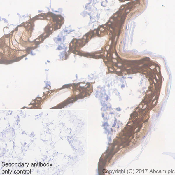 Immunohistochemistry (Formalin/PFA-fixed paraffin-embedded sections) - Anti-Cytokeratin 5 antibody [EP1601Y] - Cytoskeleton Marker (AB52635)