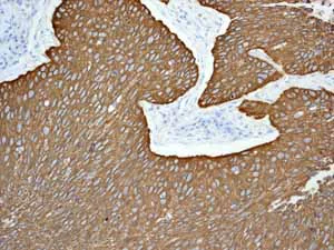 Immunohistochemistry (Formalin/PFA-fixed paraffin-embedded sections) - Anti-Cytokeratin 5 antibody [EP1601Y] - Cytoskeleton Marker (AB52635)