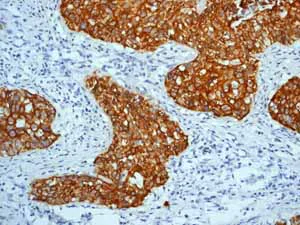 Immunohistochemistry (Formalin/PFA-fixed paraffin-embedded sections) - Anti-Cytokeratin 5 antibody [EP1601Y] - Cytoskeleton Marker (AB52635)