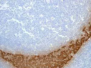 Immunohistochemistry (Formalin/PFA-fixed paraffin-embedded sections) - Anti-Cytokeratin 5 antibody [EP1601Y] - Cytoskeleton Marker (AB52635)