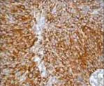 Immunohistochemistry (Formalin/PFA-fixed paraffin-embedded sections) - Anti-Cytokeratin 5 antibody [EP1601Y] - Cytoskeleton Marker (AB52635)
