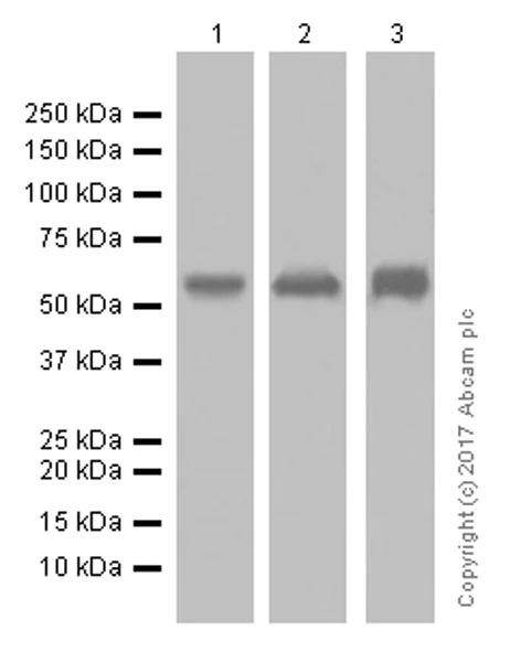 Western blot - Anti-Cytokeratin 5 antibody [EP1601Y] - Cytoskeleton Marker (AB52635)