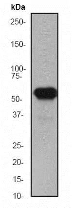 Western blot - Anti-Cytokeratin 5 antibody [EP1601Y] - Cytoskeleton Marker (AB52635)