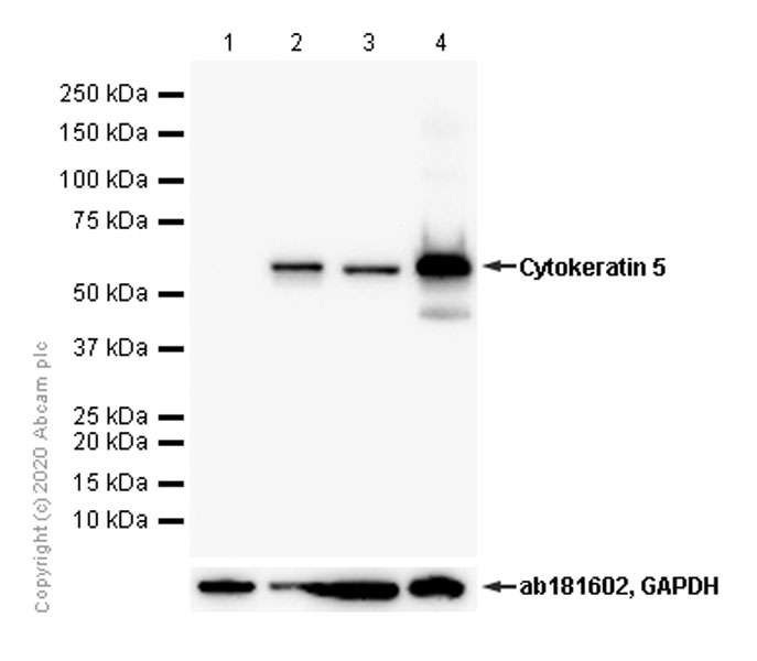 Western blot - Anti-Cytokeratin 5 antibody [EP1601Y] - Cytoskeleton Marker (AB52635), expandable thumbnail