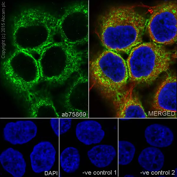 Immunocytochemistry/ Immunofluorescence - Anti-Cytokeratin 5 antibody [EPR1600Y] (AB75869)