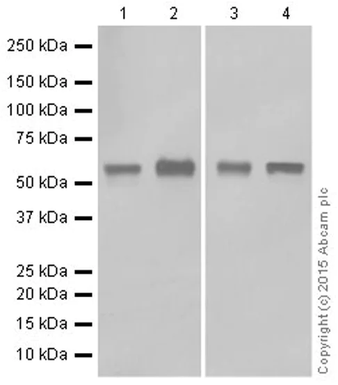 Western blot - Anti-Cytokeratin 5 antibody [EPR1600Y] (AB75869)