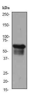 Western blot - Anti-Cytokeratin 5 antibody [EPR1600Y] (AB75869)