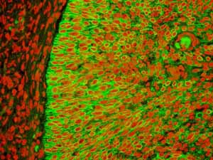 Immunohistochemistry (Formalin/PFA-fixed paraffin-embedded sections) - Anti-Cytokeratin 5 antibody [EPR1600Y] - BSA and Azide free (AB239869)