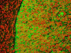 Immunohistochemistry (Formalin/PFA-fixed paraffin-embedded sections) - Anti-Cytokeratin 5 antibody [EPR1600Y] - BSA and Azide free (AB239869)