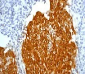 Immunohistochemistry (Formalin/PFA-fixed paraffin-embedded sections) - Anti-Cytokeratin 5 antibody [EPR1600Y] - BSA and Azide free (AB239869)
