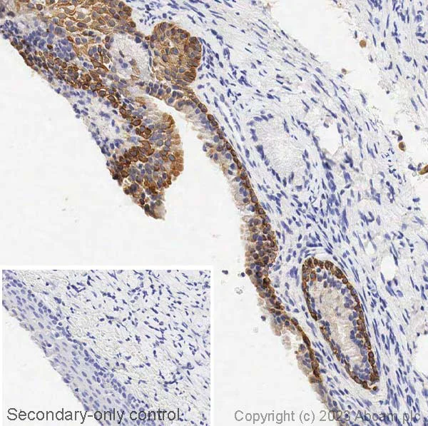 Immunohistochemistry (Formalin/PFA-fixed paraffin-embedded sections) - Anti-Cytokeratin 5 antibody [EPR1600Y] - BSA and Azide free (AB239869)