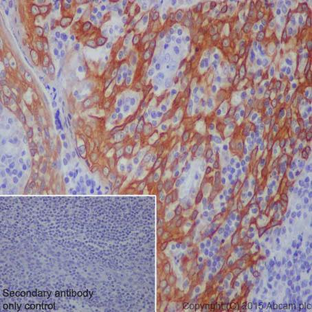Immunohistochemistry (Formalin/PFA-fixed paraffin-embedded sections) - Anti-Cytokeratin 5 antibody [EPR1600Y] - BSA and Azide free (AB239869)