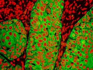 Immunohistochemistry (Formalin/PFA-fixed paraffin-embedded sections) - Anti-Cytokeratin 5 antibody [EPR1600Y] - BSA and Azide free (AB239869)
