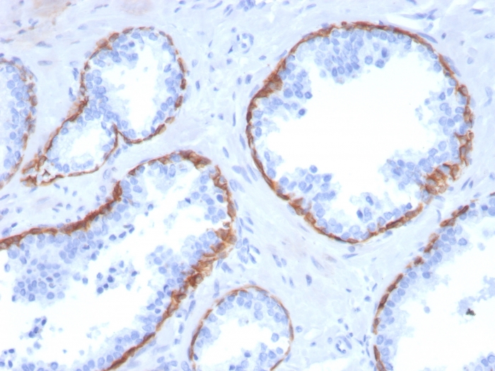 Immunohistochemistry (Formalin/PFA-fixed paraffin-embedded sections) - Anti-Cytokeratin 5 antibody [KRT5/3594] - BSA and Azide free (AB259432), expandable thumbnail