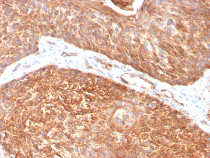 Immunohistochemistry (Formalin/PFA-fixed paraffin-embedded sections) - Anti-Cytokeratin 5 antibody [KRT5/3594] - BSA and Azide free (AB259432)