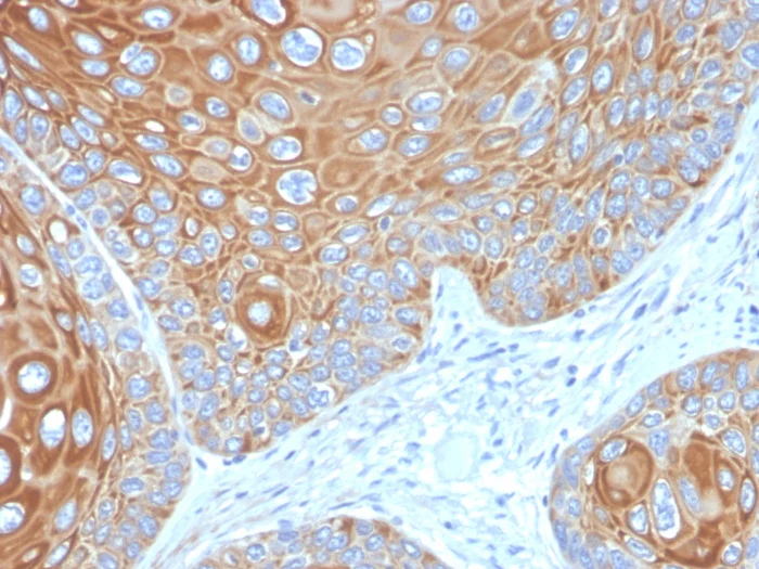 Immunohistochemistry (Formalin/PFA-fixed paraffin-embedded sections) - Anti-Cytokeratin 5 antibody [KRT5/3594] - BSA and Azide free (AB259432)