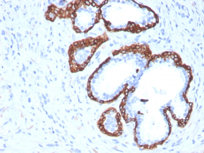 Immunohistochemistry (Formalin/PFA-fixed paraffin-embedded sections) - Anti-Cytokeratin 5 antibody [KRT5/3594] - BSA and Azide free (AB259432), expandable thumbnail