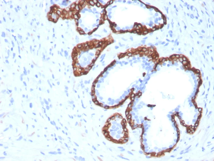Immunohistochemistry (Formalin/PFA-fixed paraffin-embedded sections) - Anti-Cytokeratin 5 antibody [KRT5/3594] - BSA and Azide free (AB259432)