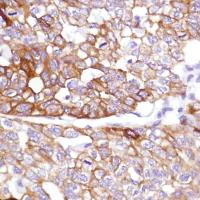 Immunohistochemistry (Formalin/PFA-fixed paraffin-embedded sections) - Anti-Cytokeratin 5 antibody [SP178] (AB183336)