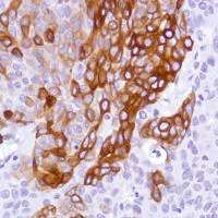 Immunohistochemistry (Formalin/PFA-fixed paraffin-embedded sections) - Anti-Cytokeratin 5 antibody [SP178] (AB183336)