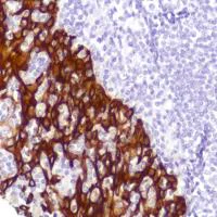 Immunohistochemistry (Formalin/PFA-fixed paraffin-embedded sections) - Anti-Cytokeratin 5 antibody [SP178] (AB183336)