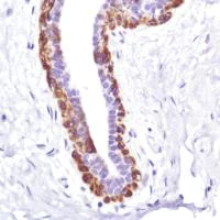 Immunohistochemistry (Formalin/PFA-fixed paraffin-embedded sections) - Anti-Cytokeratin 5 antibody [SP178] (AB183336)