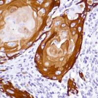 Immunohistochemistry (Formalin/PFA-fixed paraffin-embedded sections) - Anti-Cytokeratin 5 antibody [SP178] (AB183336)