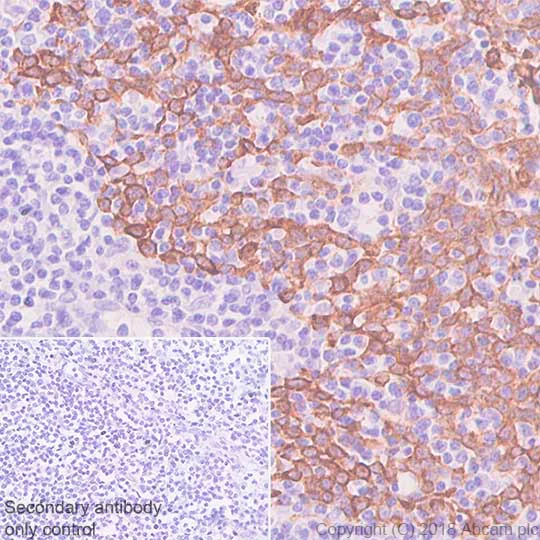 Immunohistochemistry (Formalin/PFA-fixed paraffin-embedded sections) - Anti-Cytokeratin 5 antibody [SP178] (AB183336)