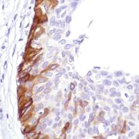 Immunohistochemistry (Formalin/PFA-fixed paraffin-embedded sections) - Anti-Cytokeratin 5 antibody [SP178] (AB183336)