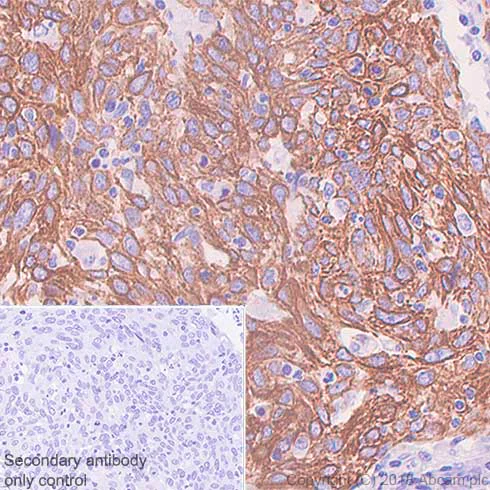 Immunohistochemistry (Formalin/PFA-fixed paraffin-embedded sections) - Anti-Cytokeratin 5 antibody [SP178] (AB183336)