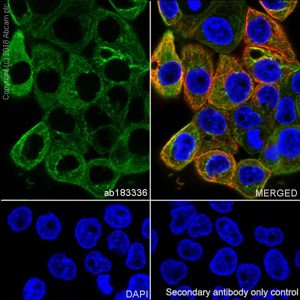 Immunocytochemistry/ Immunofluorescence - Anti-Cytokeratin 5 antibody [SP178] - BSA and Azide free (AB243922)