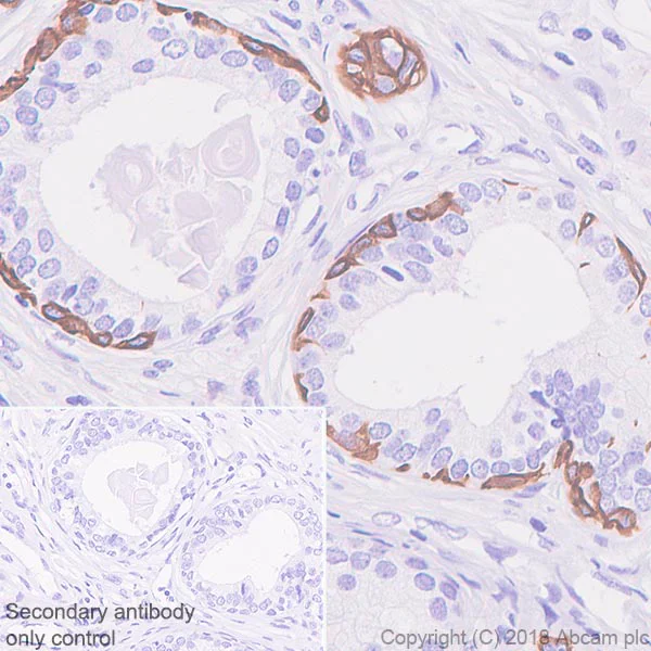 Immunohistochemistry (Formalin/PFA-fixed paraffin-embedded sections) - Anti-Cytokeratin 5 antibody [SP178] - BSA and Azide free (AB243922)