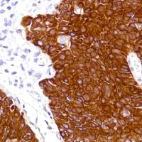 Immunohistochemistry (Formalin/PFA-fixed paraffin-embedded sections) - Anti-Cytokeratin 5 antibody [SP178] - BSA and Azide free (AB243922)