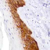 Immunohistochemistry (Formalin/PFA-fixed paraffin-embedded sections) - Anti-Cytokeratin 5 antibody [SP178] - BSA and Azide free (AB243922)