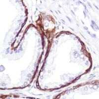 Immunohistochemistry (Formalin/PFA-fixed paraffin-embedded sections) - Anti-Cytokeratin 5 antibody [SP178] - BSA and Azide free (AB243922)