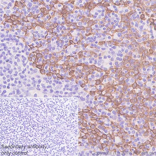 Immunohistochemistry (Formalin/PFA-fixed paraffin-embedded sections) - Anti-Cytokeratin 5 antibody [SP178] - BSA and Azide free (AB243922)