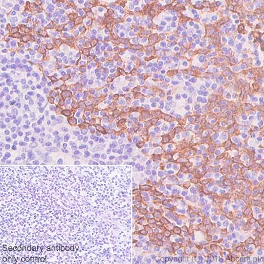 Immunohistochemistry (Formalin/PFA-fixed paraffin-embedded sections) - Anti-Cytokeratin 5 antibody [SP178] - BSA and Azide free (AB243922)