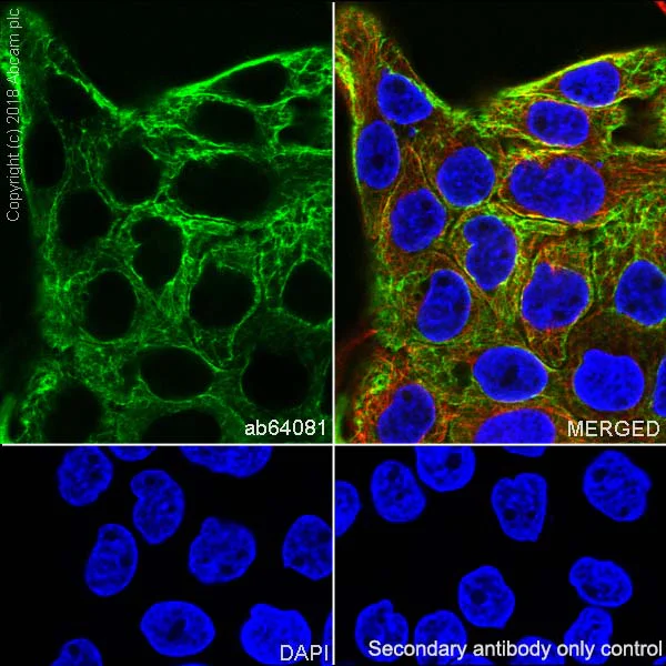 Immunocytochemistry/ Immunofluorescence - Anti-Cytokeratin 5 antibody [SP27] (AB64081)